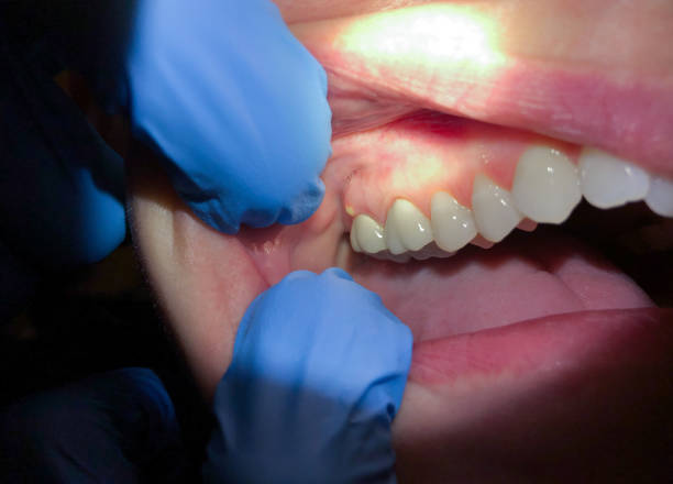 Best Cracked Tooth Emergency Dentist  in Bonneauville, PA